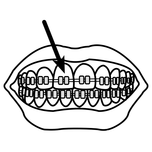 Pictograma de brackets para niños con TEA