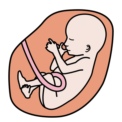 Pictograma de feto para niños con TEA