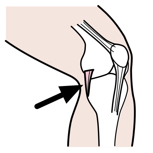 Pictograma de ligamento para niños con TEA