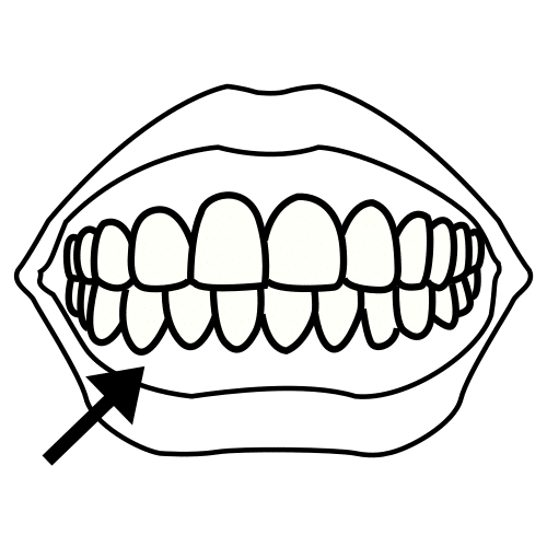 Pictograma de dientes para niños con autismo y TEA