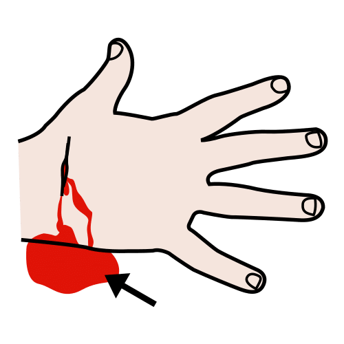 Pictograma de sangre para niños con autismo y TEA
