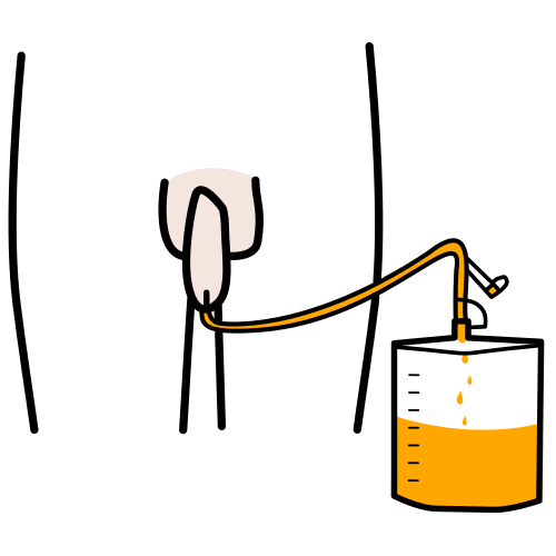 Pictograma de sonda vesical para niños con autismo y TEA