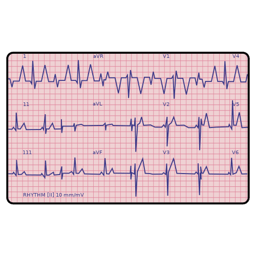 Pictograma de electrocardiograma para niños con autismo y TEA