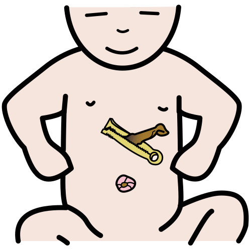Pictograma de cordón umbilical para niños con TEA