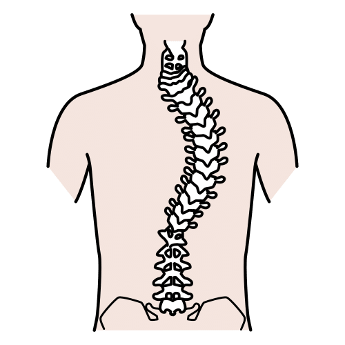 Pictograma de escoliosis para niños con autismo y TEA