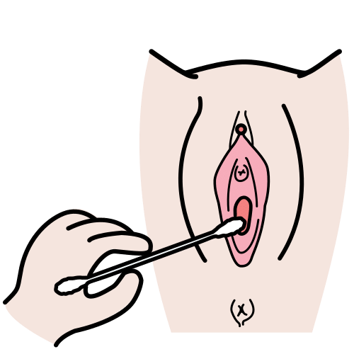 Pictograma de citología vaginal para niños con autismo y TEA