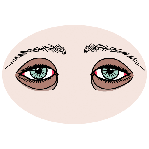 Pictograma de ojeras para niños con TEA