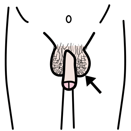 Pictograma de pene para niños con TEA