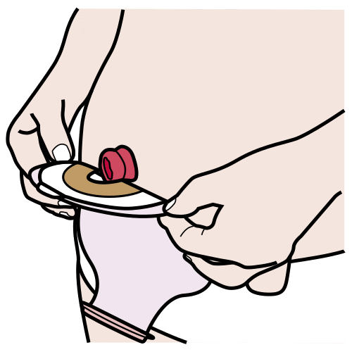 Pictograma de poner bolsa de ostomía para niños con TEA