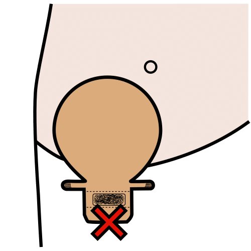 Pictograma de estreñimiento por ostomía para niños con autismo y TEA