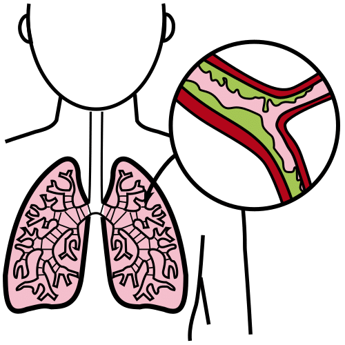 Pictograma de bronquitis para niños con autismo y TEA