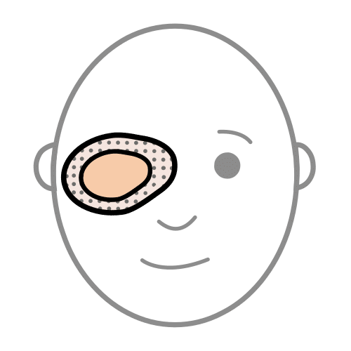 Pictograma de parche para niños con TEA