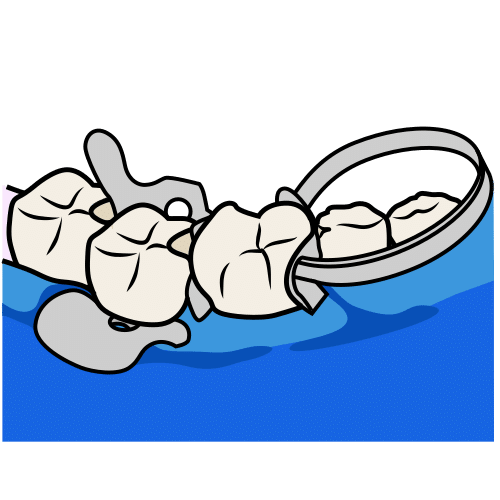Pictograma de clamp dental para niños con autismo y TEA